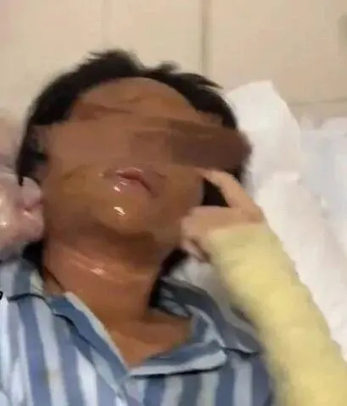 Nữ phát thanh viên xinh đẹp bị biến dạng gương mặt sau khi nhận gói hàng lạ Ảnh 2