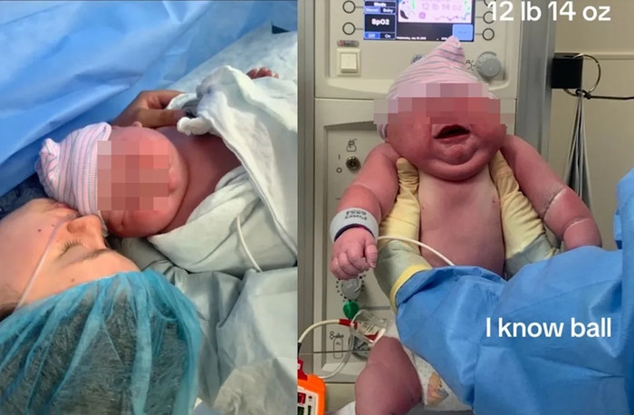 Người mẹ trẻ gây sốc khi sinh con trai nặng gần 6 kg, phá kỷ lục bệnh viện Ảnh 4