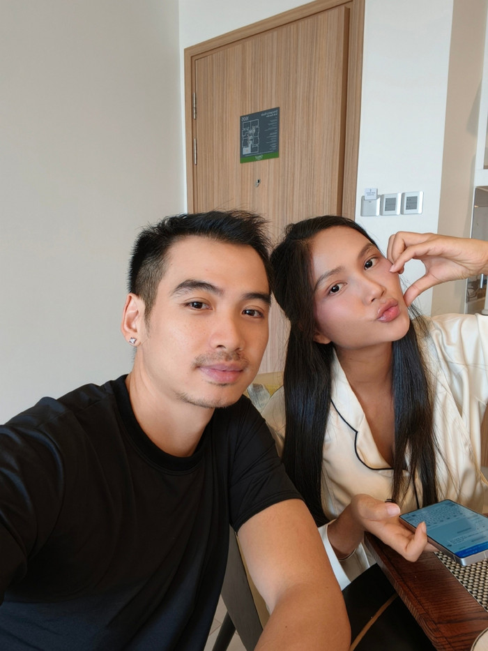 Sau hơn 5 tháng kể từ khi cấy tóc, mái tóc của Tuấn Khôi đã có sự chuyển biến rõ rệt. Anh cũng tự tin và không còn phải thường xuyên đội mũ để che đi khuyết điểm.