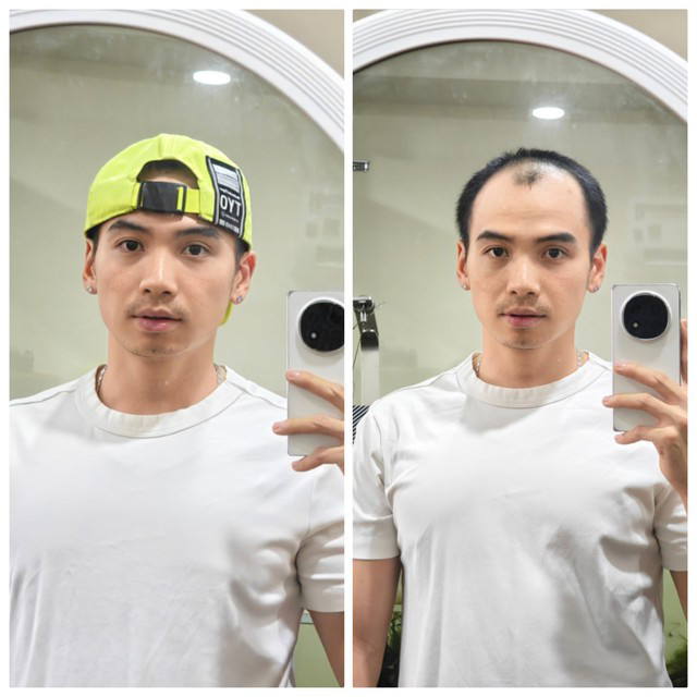 Vì hói đầu, Tuấn Khôi phải đội mũ để tự tin hơn.