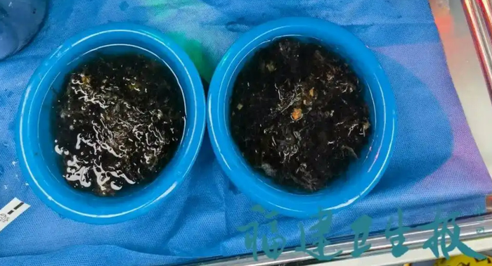 Ảnh: Tin tức y tế Phúc Kiến.