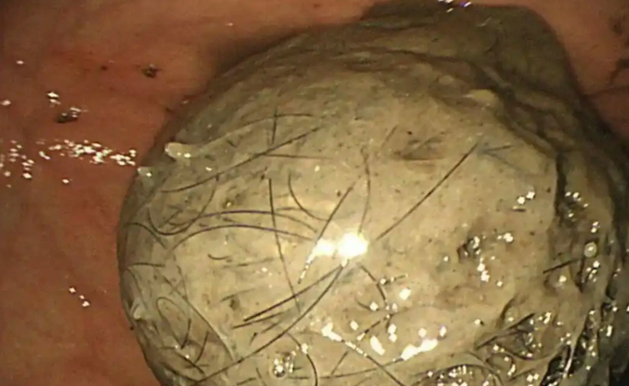 Ảnh: Tin tức y tế Phúc Kiến.