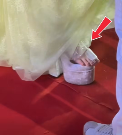 Cận cảnh bàn chân bị thương của Hòa Minzy khiến cô phải chống nạng dự sự kiện.