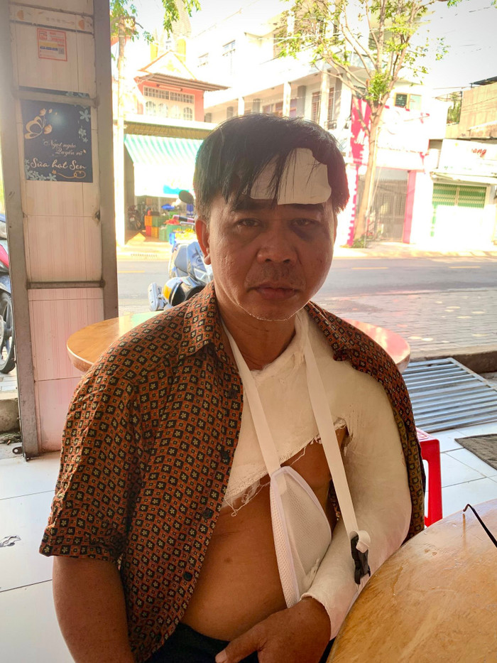 Nam diễn viên bó bột ở vai, trán dính băng gạc. Ảnh: FBNV