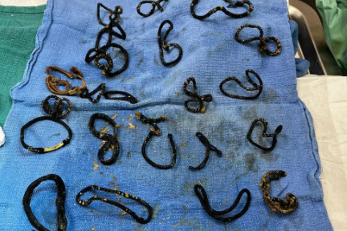 Con mèo bị tắc ruột nghiêm trọng, bác sĩ kiểm tra thì phát hiện sự thật khiến ai cũng bàng hoàng Ảnh 2