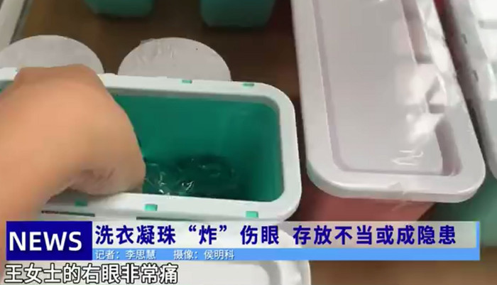 Dùng tay tách viên giặt máy bị dính vào nhau, người phụ nữ gặp sự cố kinh hoàng Ảnh 3