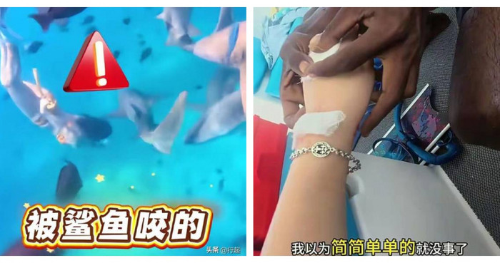 Nữ du khách bị cá mập cắn khi lặn biển, thái độ sau đó khiến cộng đồng mạng tranh cãi Ảnh 1