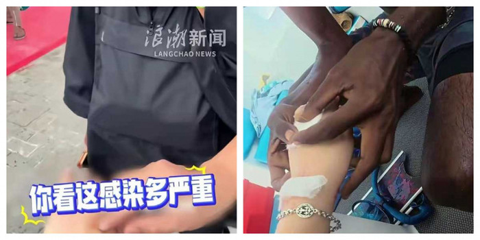 Nữ du khách bị cá mập cắn khi lặn biển, thái độ sau đó khiến cộng đồng mạng tranh cãi Ảnh 3