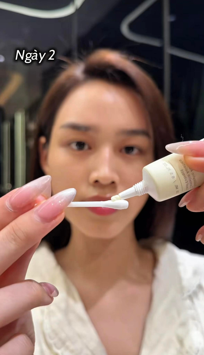 Đỗ Thị Hà sử dụng kem chấm mụn 200 nghìn. Ảnh chụp màn hình