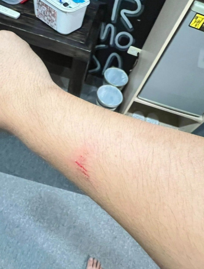 Kinh hoàng trần phòng khách sạn sập giữa đêm, bê tông rơi trúng khách khi đang nghỉ ngơi Ảnh 2