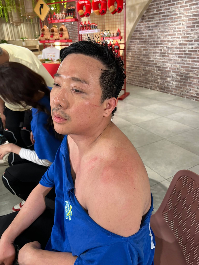 Trạng thái bất ổn của Trấn Thành Ảnh 2