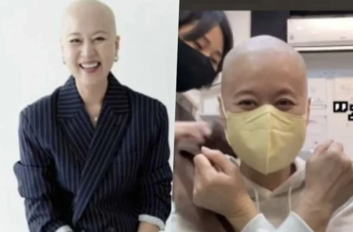 Park Mi Sun chia sẻ toàn bộ quá trình cắt tóc trước đợt hóa trị - hình ảnh khiến nhiều khán giả xót xa.