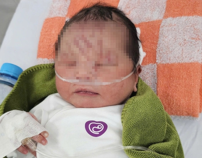 Nhờ được các bác sĩ cứu chữa tận tình, bé gái sơ sinh bị bỏ rơi đã được cứu sống kịp thời. Ảnh: báo Người Lao Động
