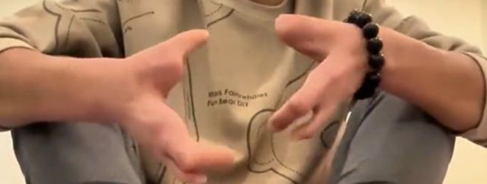 Người đàn ông sinh ra với bàn chân 'móng bò' và tay 'càng cua', lý do ai nghe cũng xót xa Ảnh 2