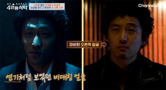 Tình trạng của nam diễn viên từng nguy hiểm đến mức anh suýt phải từ bỏ sự nghiệp nghệ thuật.&nbsp;