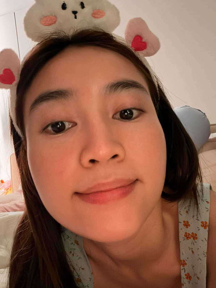 Nữ diễn viên cập nhật tình trạng của làn da ở hiện tại sau thời gian điều trị.&nbsp;