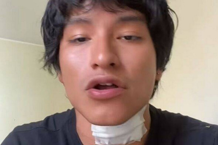 Nam ca sĩ bị điện giật gục ngã trên sân khấu khiến khán giả bàng hoàng Ảnh 2