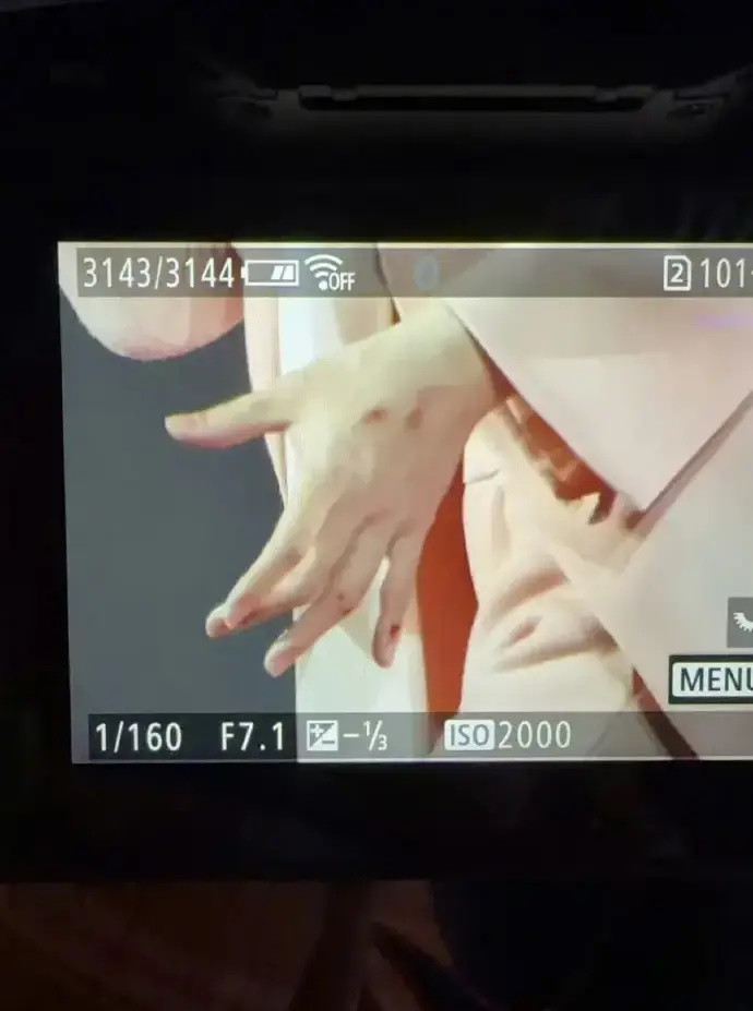 Nam ca sĩ bước hụt chân, rơi khỏi sân khấu cao 2m khiến khán giả bàng hoàng Ảnh 5