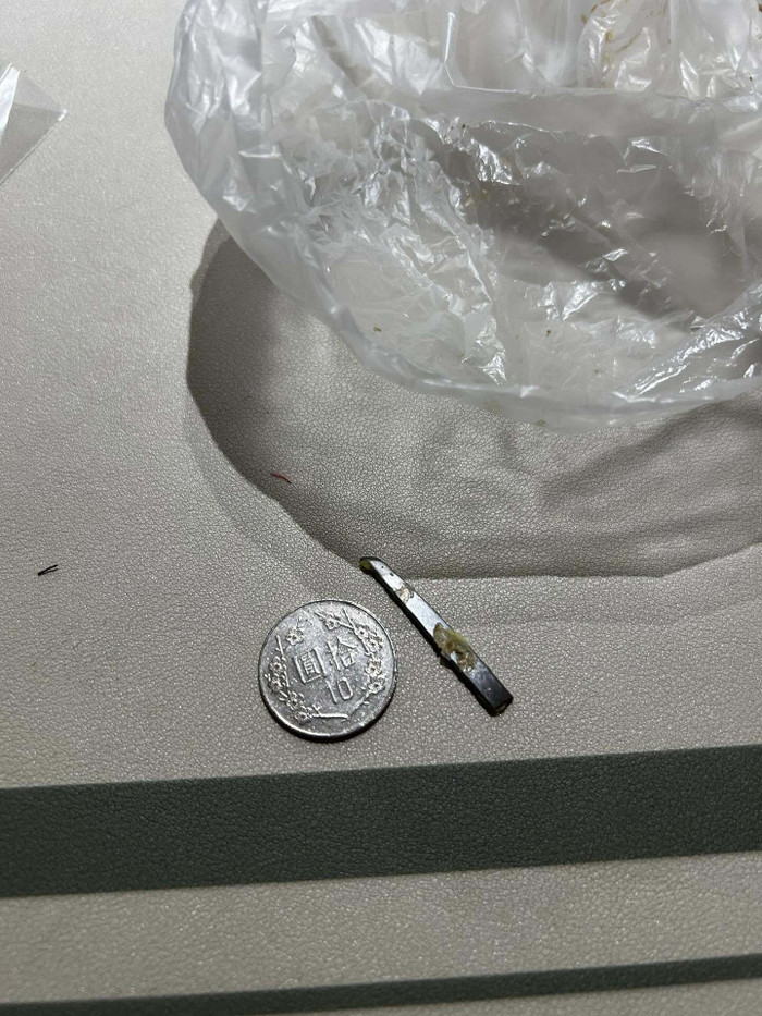 Ăn bánh bao kẹp trứng, người đàn ông kinh hoàng khi phát hiện vật nguy hiểm bên trong Ảnh 2