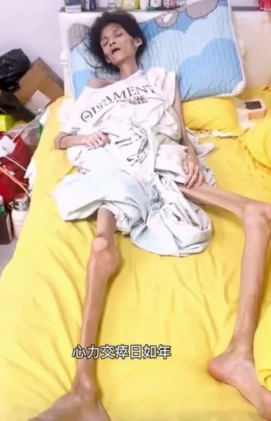 Cô gái 27 tuổi nặng 17kg qua đời, câu chuyện đằng sau khiến dư luận đau xót Ảnh 1