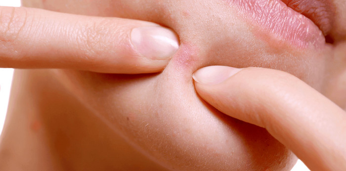 Ảnh minh họa&nbsp;