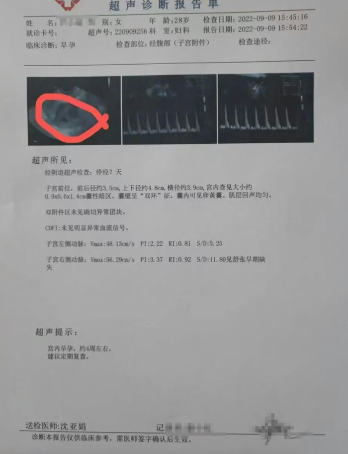 Cô dâu bị phạt tù 4 năm rưỡi sau khi đám cưới, chú rể gục ngã khi biết sự thật Ảnh 2