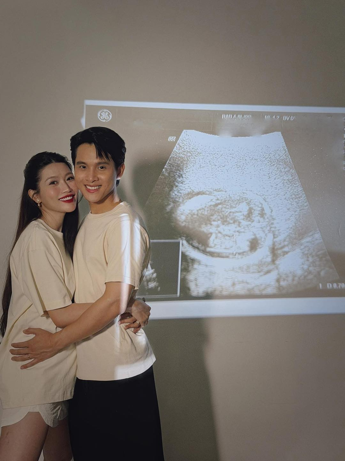 Á hậu Chế Nguyễn Quỳnh Châu xác nhận tin mang thai con đầu lòng với chồng thiếu gia mới đây.