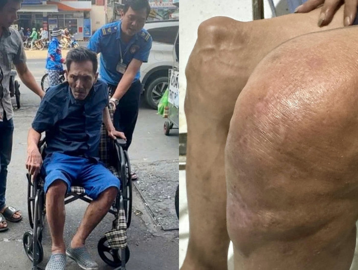 Vào tháng 12/2024, Thương Tín được chẩn đoán thoái hóa khớp và gãy xương bánh chè.