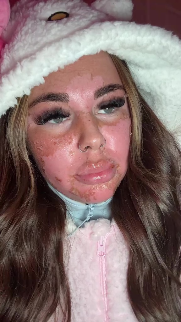 Bài học đắt giá từ giường tắm nắng: Cô gái trẻ cảnh báo hậu quả kinh hoàng Ảnh 1