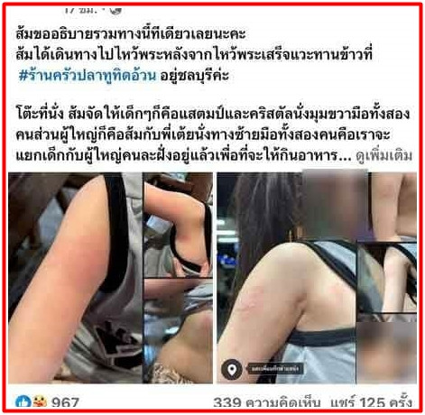 Bé gái 5 tuổi bị bỏng do nhân viên nhà hàng đổ súp nóng lên tay, người mẹ đăng bài 'bóc phốt' Ảnh 2