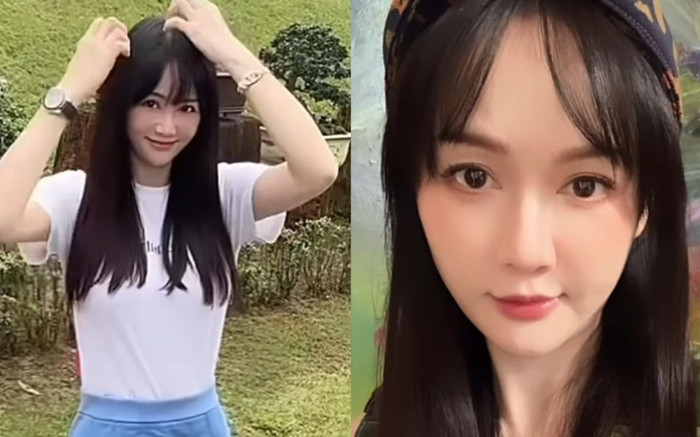 Nữ diễn viên mặt sưng phù sau thẩm mỹ, trốn ở nhà suốt 1 tháng qua Ảnh 2