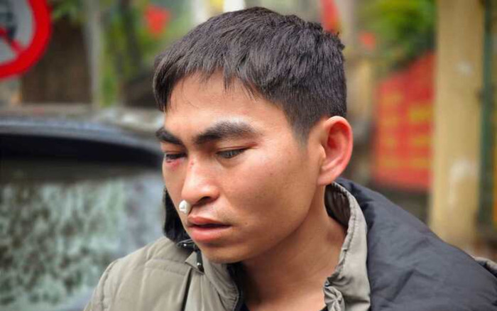 Nam shipper bị tài xế Lexus hành hung: Vẫn đau đầu và choáng váng, chưa nhận được lời xin lỗi Ảnh 2