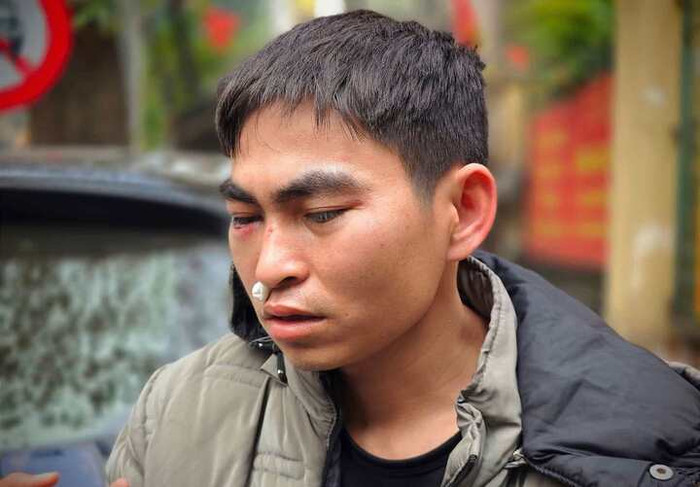 Anh Hưng vẫn chưa ổn định sau khi bị hành hung.