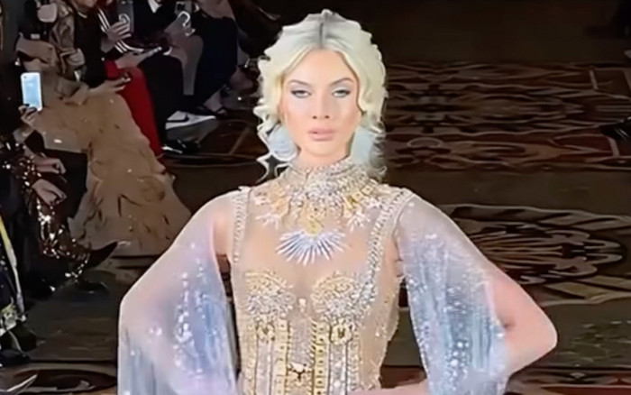 Đương kim Hoa hậu Hoàn vũ bị chê Ảnh 2