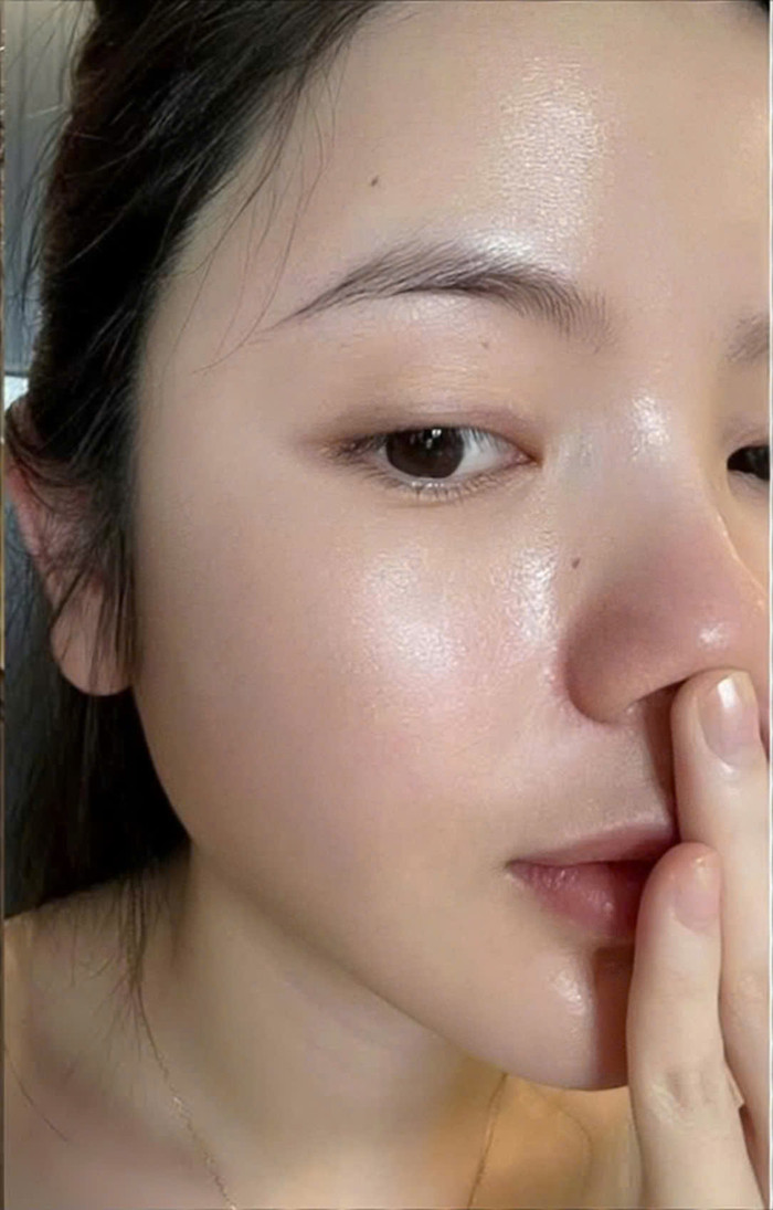 Tuy nhiên, chỉ sau một thời gian kiên trì chăm sóc, làn da của Chu Thanh Huyền đã có sự cải thiện đáng kể. Trong bức ảnh mới nhất, gương mặt nàng WAG đã trở nên mịn màng, căng bóng và trắng sáng hơn Lỗ chân lông se khít, các vết mụn và sẹo trước đây gần như biến mất hoàn toàn. Dưới bài viết, nhiều chị em nhiệt tình xin bí quyết để có được làn da mơ ước. Ảnh: FBNV