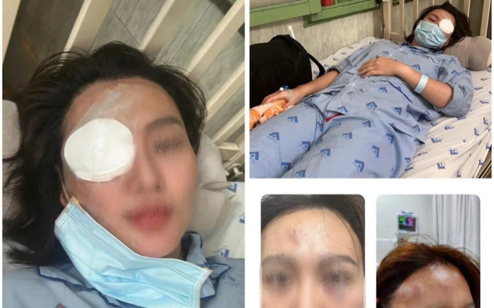 Cô gái bị bạn trai hành hung thương tật 23%, diễn biến sự việc gây chú ý Ảnh 2