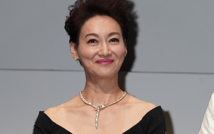 Nữ diễn viên nổi tiếng gây sốc với gương mặt biến dạng, lý do khiến ai cũng xót xa Ảnh 2