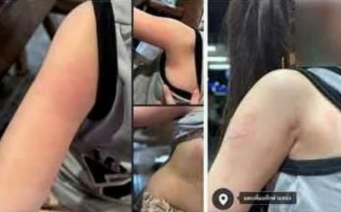 Bé gái 5 tuổi bị bỏng do nhân viên nhà hàng đổ súp nóng lên tay, người mẹ đăng bài 'bóc phốt' Ảnh 2
