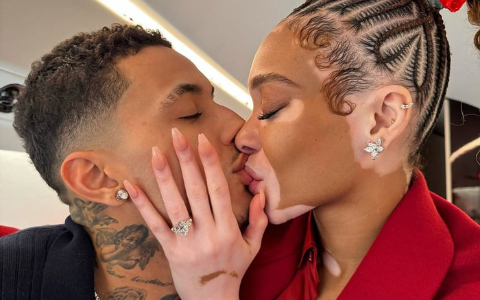 Người mẫu bạch biến được cầu hôn bằng nhẫn kim cương 8,5 carat Ảnh 2