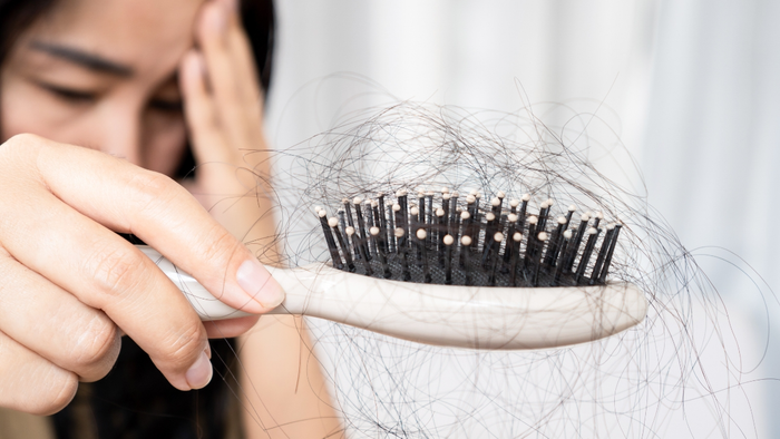 Cậu bé 16 tuổi 'hói nửa đầu' vì một thói quen cơ bản mà ai cũng mắc phải! Ảnh 2