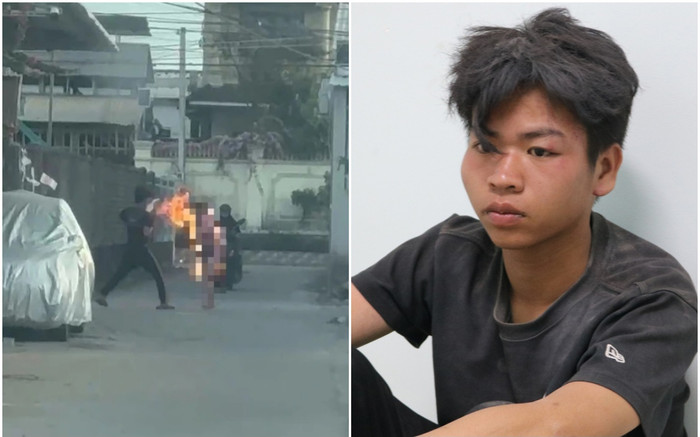 Nhói lòng lời 'ruột gan' của người mẹ đang nguy kịch vì bị con trai tạt xăng đốt Ảnh 2