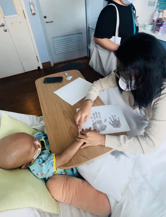 Tình trạng đáng lo của bé Bắp Ảnh 3