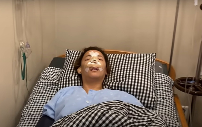 Nữ diễn viên nổi tiếng vừa sửa mũi đã gặp tai nạn nghiêm trọng Ảnh 2