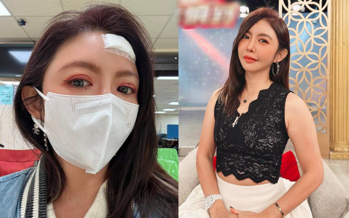 Nữ người mẫu tiết lộ bị chồng 'tác động vật lý' đến gãy xương Ảnh 2