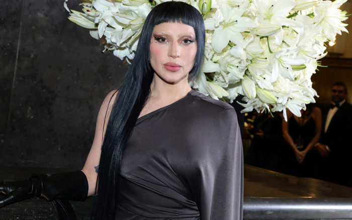 Lady Gaga mắc chứng rối loạn tâm thần Ảnh 2