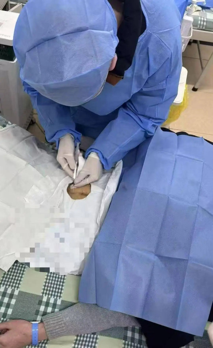 Người phụ nữ được cấy 'chip cai rượu'.