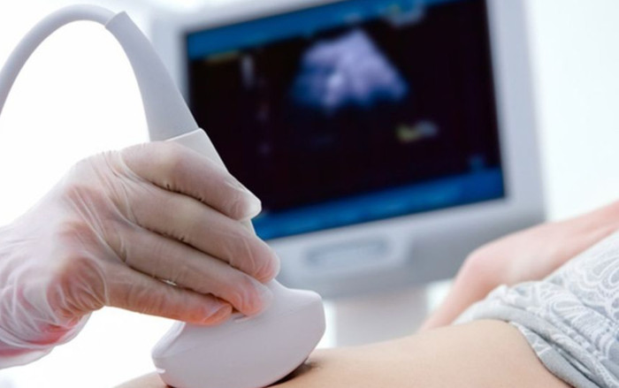 Hy hữu người phụ nữ sinh con sau 1 ngày phát hiện mang thai Ảnh 2