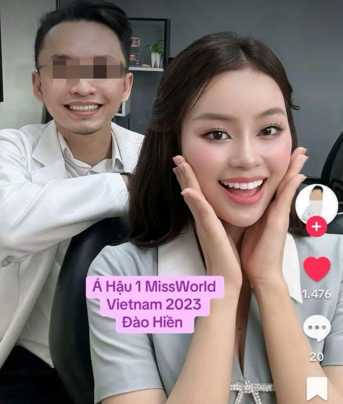 Xuất hiện hình ảnh Á hậu Đào Hiền can thiệp phương pháp dán sứ cho răng. Nhiều khán giả cho rằng đây là nguyên nhân khiến cô bị loại sớm. (Ảnh tổng hợp)