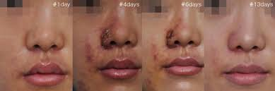 Không đụng dao kéo, mũi vẫn cao, chuyện thật như đùa! Ảnh 4