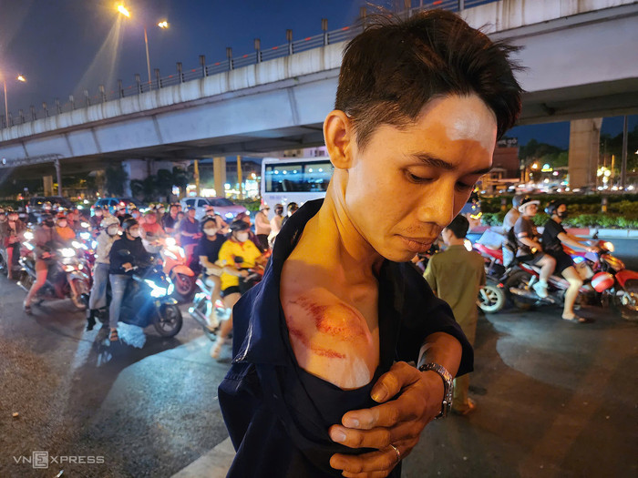 Nạn nhân của vụ 'xe điên' tông văng 10 xe máy. Ảnh: VnExpress